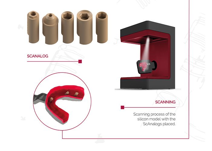 ScAnalog: Digitalize implant positions