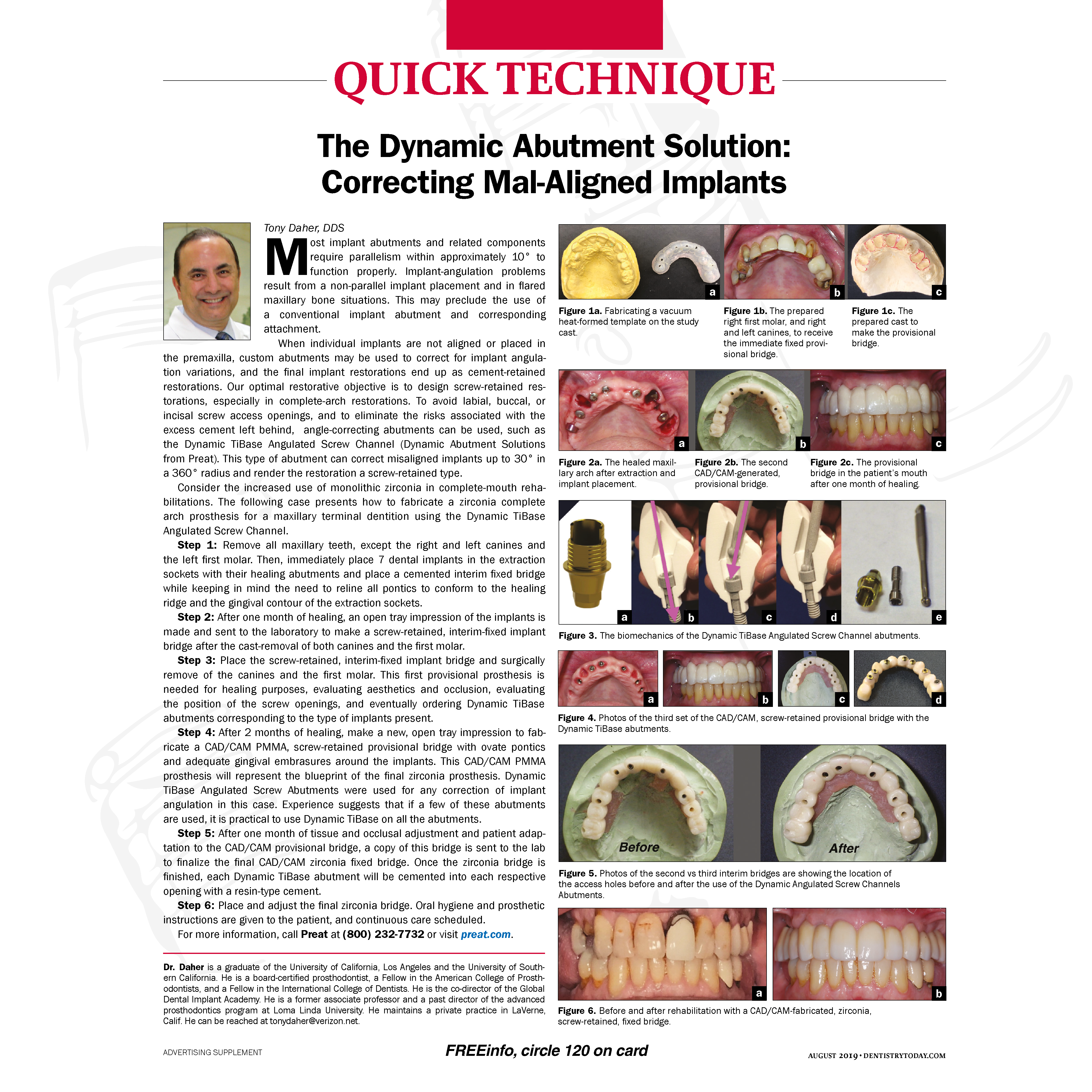 Article by Dr. Tony Daher DDS about Tibase