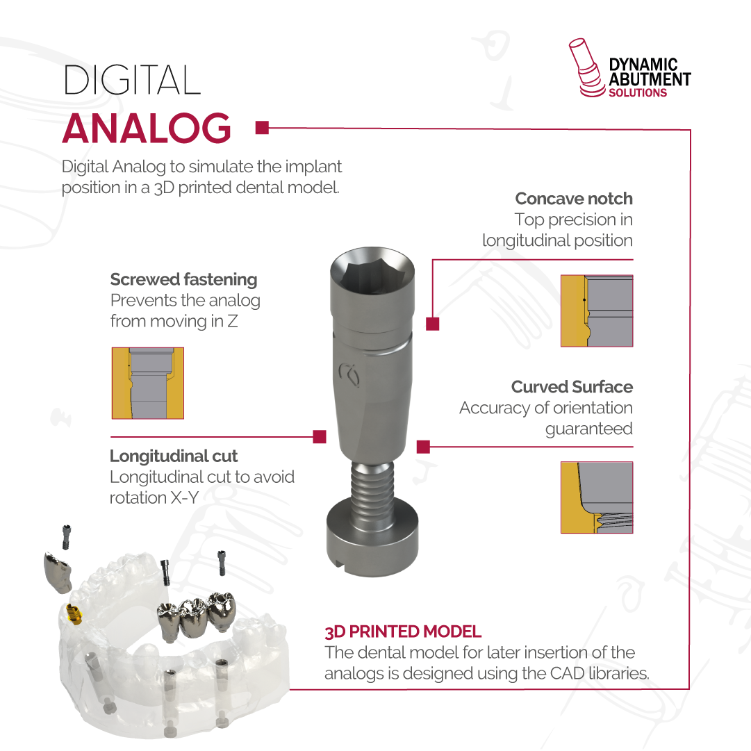 Digital Analog