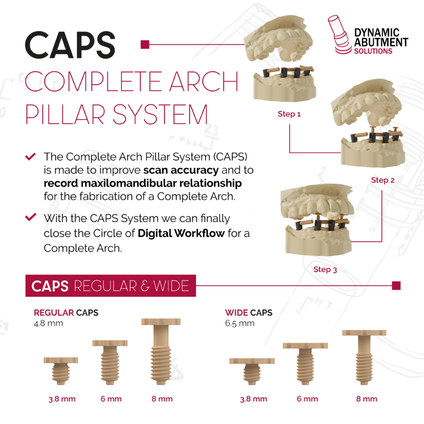 CAPS Complete Arch Pillar System