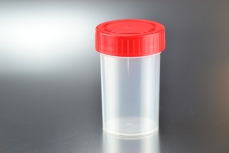 rojo 20 x vasos de orina de 120 ml con tapa de rosca vaso de muestra de orina vaso multiusos vaso de plástico 